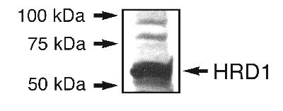 Detection of HRD1 in an endogenous 293T cell lysate.