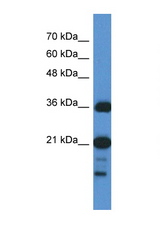 C1orf144 antibody LS-C116608 Western blot of HepG2 Cell lysate. Antibody concentration 1 ug/ml.