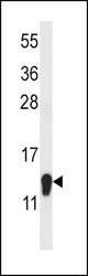 C1orf144 Antibody western blot of mouse liver tissue lysates (35 ug/lane). The C1orf144 antibody detected the C1orf144 protein (arrow).
