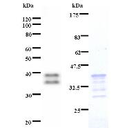 Left : Western blot analysis of immunized recombinant protein, using anti-HIVEP2 monoclonal antibody. Right : CBB staining of immunized recombinant protein.