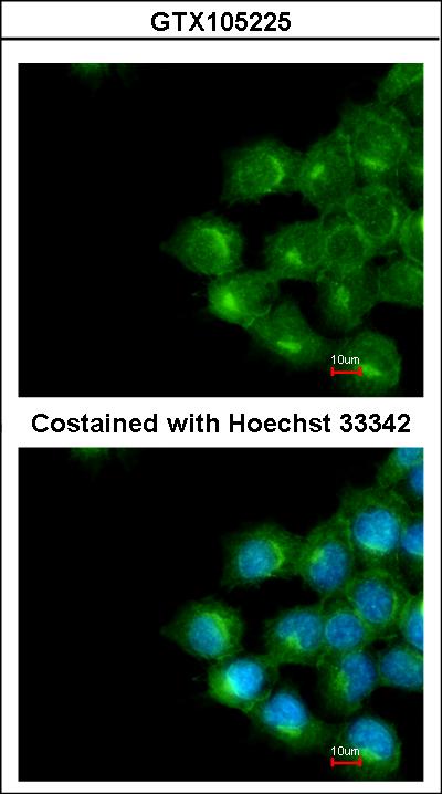 Immunofluorescence of methanol-fixed A431 using Scramblase1 antibody at 1:200 dilution.