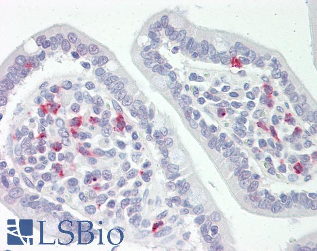 Human Small Intestine: Formalin-Fixed, Paraffin-Embedded (FFPE)