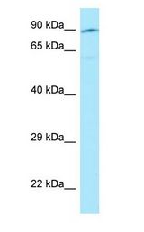 Semaphorin 3E / SEMA3E antibody Western Blot of 721_B.