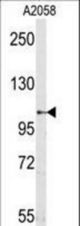 Western blot of mouse anti-Sema5a antibody in A2058 cell line lysates (35 ug/lane). Sema5a(arrow) was detected using the purified antibody.