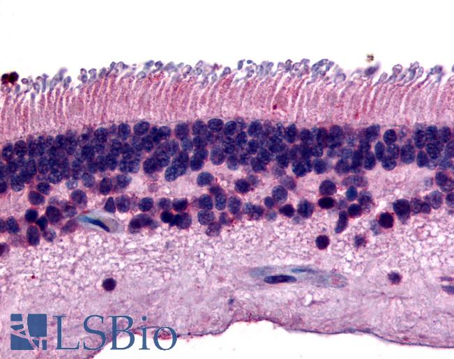 Anti-PTPRM antibody LS-A2864 IHC of human eye, retina. Immunohistochemistry of formalin-fixed, paraffin-embedded tissue after heat-induced antigen retrieval.