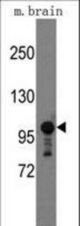 Western blot of mouse anti-Semaphorin 5A antibody in mouse brain tissue lysates (35 ug/lane). Semaphorin 5A(arrow) was detected using the purified antibody.