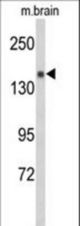Western blot of Semaphorin 5A-S106 Antibody in mouse brain tissue lysates (35 ug/lane). Semaphorin 5A (arrow) was detected using the purified antibody.