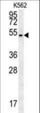 HHAT Antibody western blot of K562 cell line lysates (35 ug/lane). The HHAT antibody detected the HHAT protein (arrow).