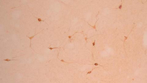 IHC: Mouse anti-Choline Transporter, High Affinity (LS-C152949). Immunolocalization of the high affinity choline transporter in mouse striatum. The transporter is selectively localized in cholinergic neurons.