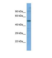 Western blot of Human ACHN. SLC5A7 antibody dilution 1.0 ug/ml.