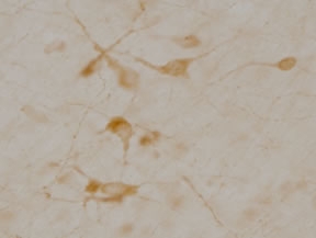 Staining of neurons in rat basal forebrain.