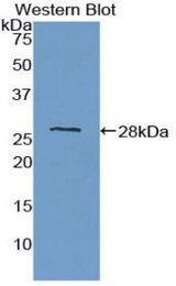 Western blot of recombinant PTPRM / PTP Mu.