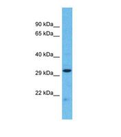 Western blot of Human 293T. PTPRM antibody dilution 1.0 ug/ml.