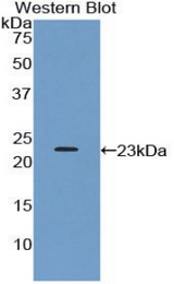 Western blot of recombinant PTPRN / IA-2.