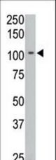 The anti-PTPIA2 beta N-term antibody is used in Western blot to detect PTPIA2 beta in C6 cell lysate.