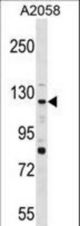 PTPRN2 Antibody western blot of A2058 cell line lysates (35 ug/lane). The PTPRN2 antibody detected the PTPRN2 protein (arrow).