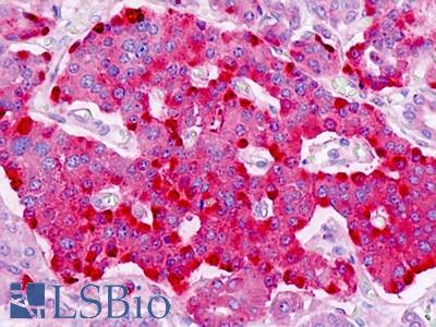 Anti-PTPRN2 / Phogrin antibody IHC staining of human pancreas, islet. Immunohistochemistry of formalin-fixed, paraffin-embedded tissue after heat-induced antigen retrieval.
