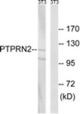 Western blot of extracts from NIH-3T3 cells, using PTPRN2 Antibody. The lane on the right is treated with the synthesized peptide.