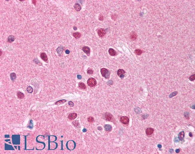 Anti-PTPRN2 antibody IHC of human brain, cortex. Immunohistochemistry of formalin-fixed, paraffin-embedded tissue after heat-induced antigen retrieval. Antibody LS-B765 concentration 5 ug/ml.