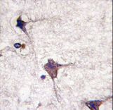 Formalin-fixed and paraffin-embedded human brain tissue reacted with hPCPTP1-Y249, which was peroxidase-conjugated to the secondary antibody, followed by DAB staining. This data demonstrates the use of this antibody for immunohistochemistry; clinical relevance has not been evaluated.