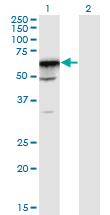 Western blot of PRPF31 expression in transfected 293T cell line by PRPF31 monoclonal antibody (M02), clone 8E1.