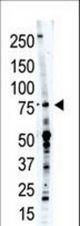 The anti-PCPTP1 antibody is used in Western blot to detect PCPTP1 in placenta tissue lysate.