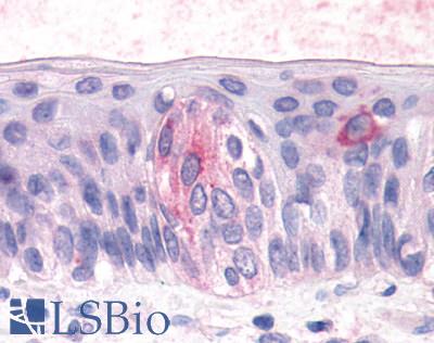 Anti-TAS1R3 antibody LS-A5073 IHC of human tongue, taste receptor cells. Immunohistochemistry of formalin-fixed, paraffin-embedded tissue after heat-induced antigen retrieval.