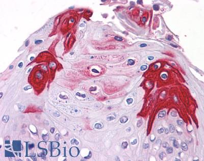 Anti-TAS1R3 antibody LS-A5060 IHC of human tongue, taste receptor. Immunohistochemistry of formalin-fixed, paraffin-embedded tissue after heat-induced antigen retrieval.