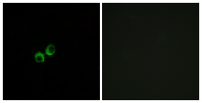 Immunofluorescence of MCF7 cells, using TAS1R3 Antibody. The picture on the right is treated with the synthesized peptide.