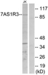 Western blot of extracts from Jurkat cells, using TAS1R3 Antibody. The lane on the right is treated with the synthesized peptide.