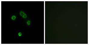 Immunofluorescence of MCF7 cells, using TAS2R13 Antibody. The picture on the right is treated with the synthesized peptide.