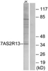 Western blot of extracts from Jurkat cells, using TAS2R13 Antibody. The lane on the right is treated with the synthesized peptide.