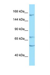 PTPRT antibody LS-C146249 Western blot of COL0205 Cell lysate. Antibody concentration 1 ug/ml.