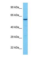 Western blot of TAB2 Antibody with human 786-0 Whole Cell lysate.