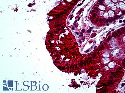 Anti-TAB2 antibody IHC of human colon. Immunohistochemistry of formalin-fixed, paraffin-embedded tissue after heat-induced antigen retrieval. Antibody LS-B5139 concentration 3.75 ug/ml.