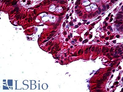 Anti-TAB2 antibody IHC of human colon. Immunohistochemistry of formalin-fixed, paraffin-embedded tissue after heat-induced antigen retrieval. Antibody LS-B5140 concentration 3.75 ug/ml.