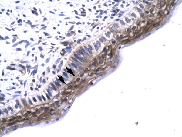 TAB2 antibody LS-C29682 was used in IHC to stain formalin-fixed, paraffin-embedded human spermatophore.