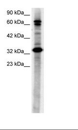 HepG2 Cell Lysate