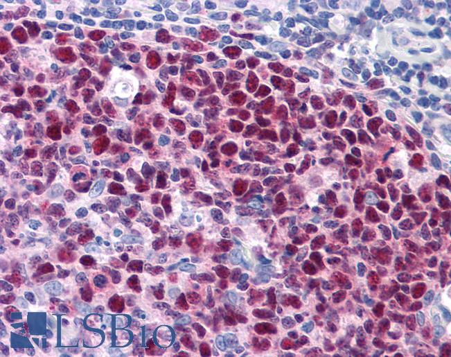 Anti-TAB2 antibody IHC of human tonsil. Immunohistochemistry of formalin-fixed, paraffin-embedded tissue after heat-induced antigen retrieval. Antibody LS-B4704 concentration 5 ug/ml.