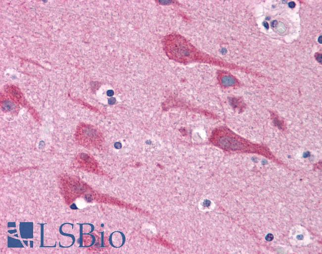 Anti-TAB2 antibody IHC of human brain, cortex. Immunohistochemistry of formalin-fixed, paraffin-embedded tissue after heat-induced antigen retrieval. Antibody LS-B4704 concentration 5 ug/ml.