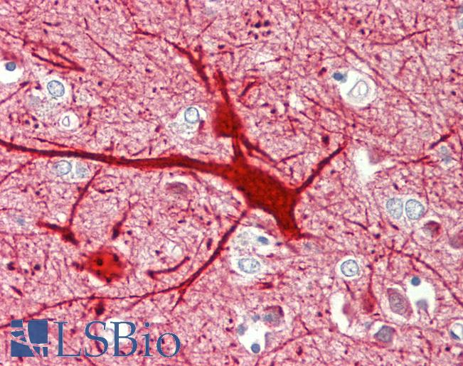 Anti-TAC3 / Tachykinin antibody IHC staining of human brain, cortex. Immunohistochemistry of formalin-fixed, paraffin-embedded tissue after heat-induced antigen retrieval.
