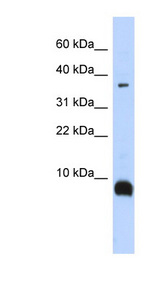 TAC3 antibody LS-C101962 Western blot of Fetal Brain lysate.