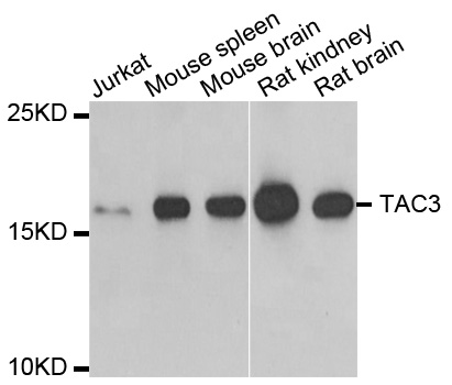 Western blot analysis of extracts of various cell lines, using TAC3 antibody.