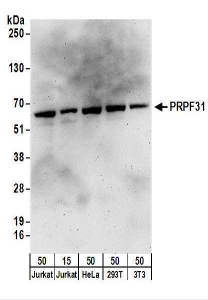 Detection of Human and Mouse PRPF31 by Western Blot. Samples: Whole cell lysate from Jurkat (15 and 50 ug), HeLa (50 ug), 293T (50 ug), and mouse NIH3T3 (50 ug) cells. Antibodies: Affinity purified rabbit anti-PRPF31 antibody used for WB at 0.1 ug/ml. Detection: Chemiluminescence with an exposure time of 3 minutes.