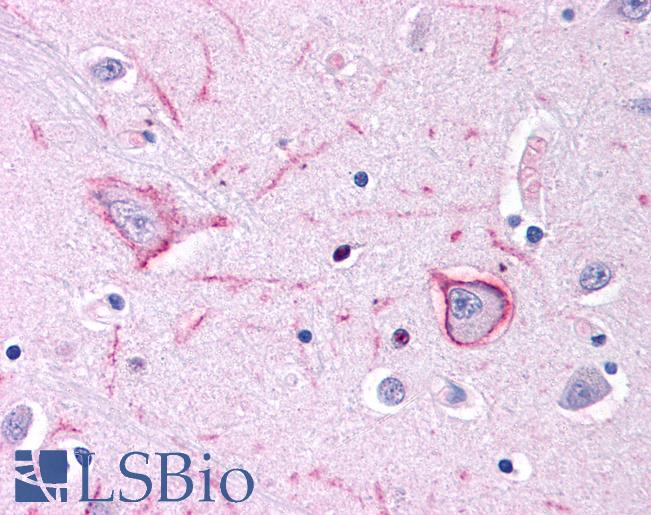 Anti-Neurokinin 1 Receptor antibody IHC of human brain, putamen. Immunohistochemistry of formalin-fixed, paraffin-embedded tissue after heat-induced antigen retrieval. Antibody LS-B500 concentration 10 ug/ml.