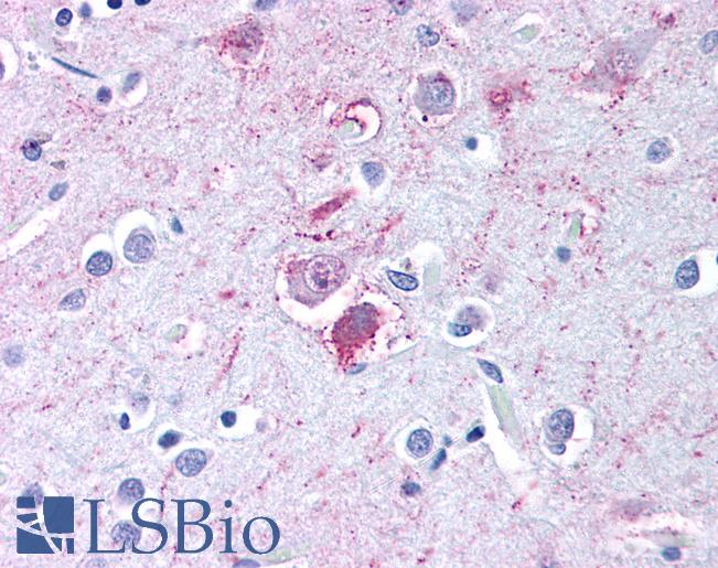 Anti-Neurokinin 1 Receptor antibody LS-A1342 IHC of human brain, cortex. Immunohistochemistry of formalin-fixed, paraffin-embedded tissue after heat-induced antigen retrieval.