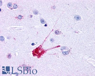 Anti-Neurokinin 1 Receptor antibody LS-A1339 IHC of human brain, neurons and glia. Immunohistochemistry of formalin-fixed, paraffin-embedded tissue after heat-induced antigen retrieval.