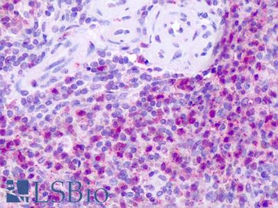 Anti-Neurokinin 1 Receptor / NK1R antibody IHC of human spleen. Immunohistochemistry of formalin-fixed, paraffin-embedded tissue after heat-induced antigen retrieval. Antibody LS-A1341 dilution 1-40 ug/ml.