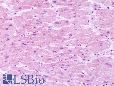 Anti-Neurokinin 1 Receptor / NK1R antibody IHC of human heart. Immunohistochemistry of formalin-fixed, paraffin-embedded tissue after heat-induced antigen retrieval. Antibody LS-A1341 dilution 1-40 ug/ml.