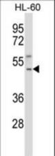 TACR1 Antibody western blot of HL-60 cell line lysates (35 ug/lane). The TACR1 antibody detected the TACR1 protein (arrow).